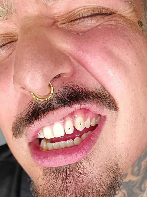 un chico con tooth gems