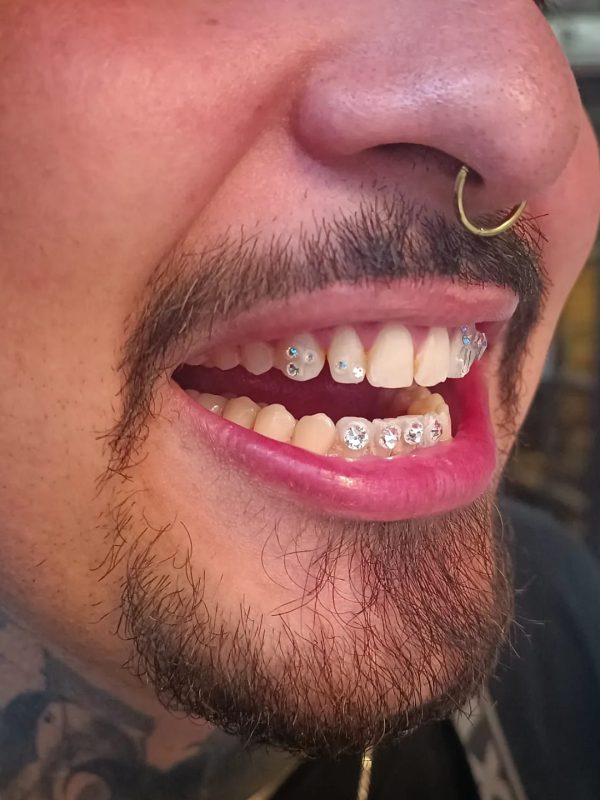 tooth gems de un chico