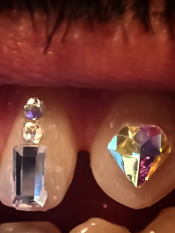 Tooth gem ejemplo