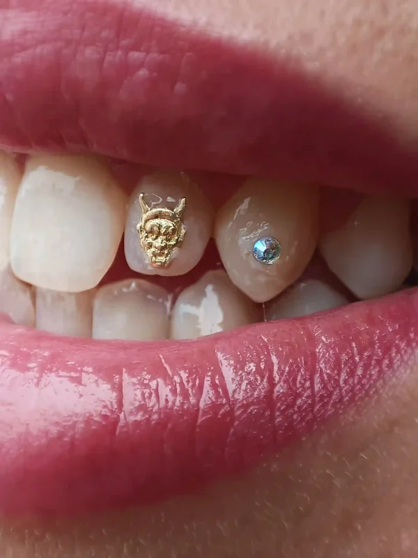 detalles de un tooth gem