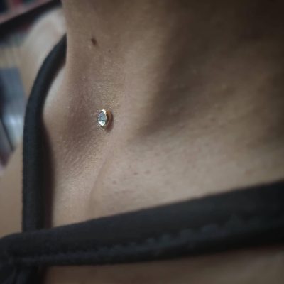 Microdermal