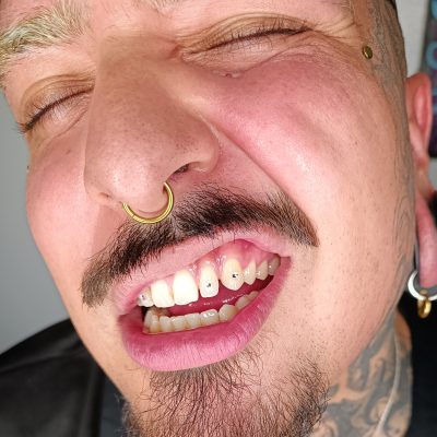 un chico con tooth gems