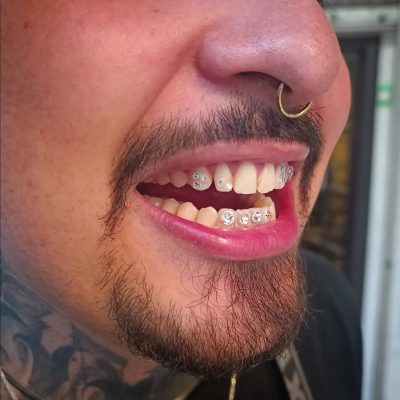 tooth gems de un chico