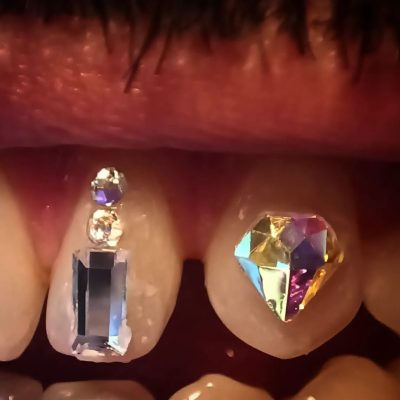 Tooth gem ejemplo